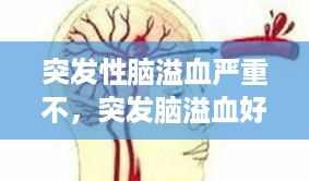 突发性脑溢血严重不，突发脑溢血好治吗 