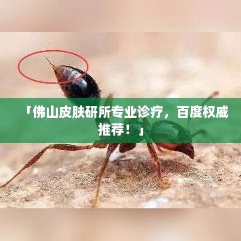 「佛山皮肤研所专业诊疗，百度权威推荐！」