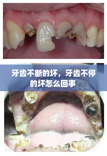 牙齿不断的坏，牙齿不停的坏怎么回事 