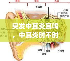 突发中耳炎耳鸣，中耳炎时不时耳鸣 