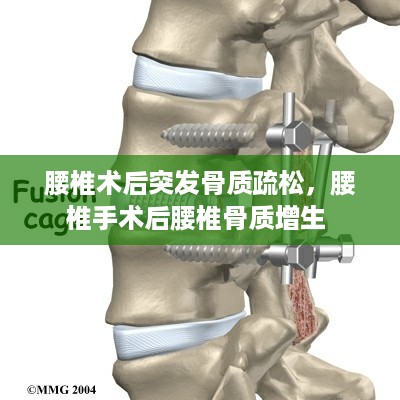 腰椎术后突发骨质疏松，腰椎手术后腰椎骨质增生 